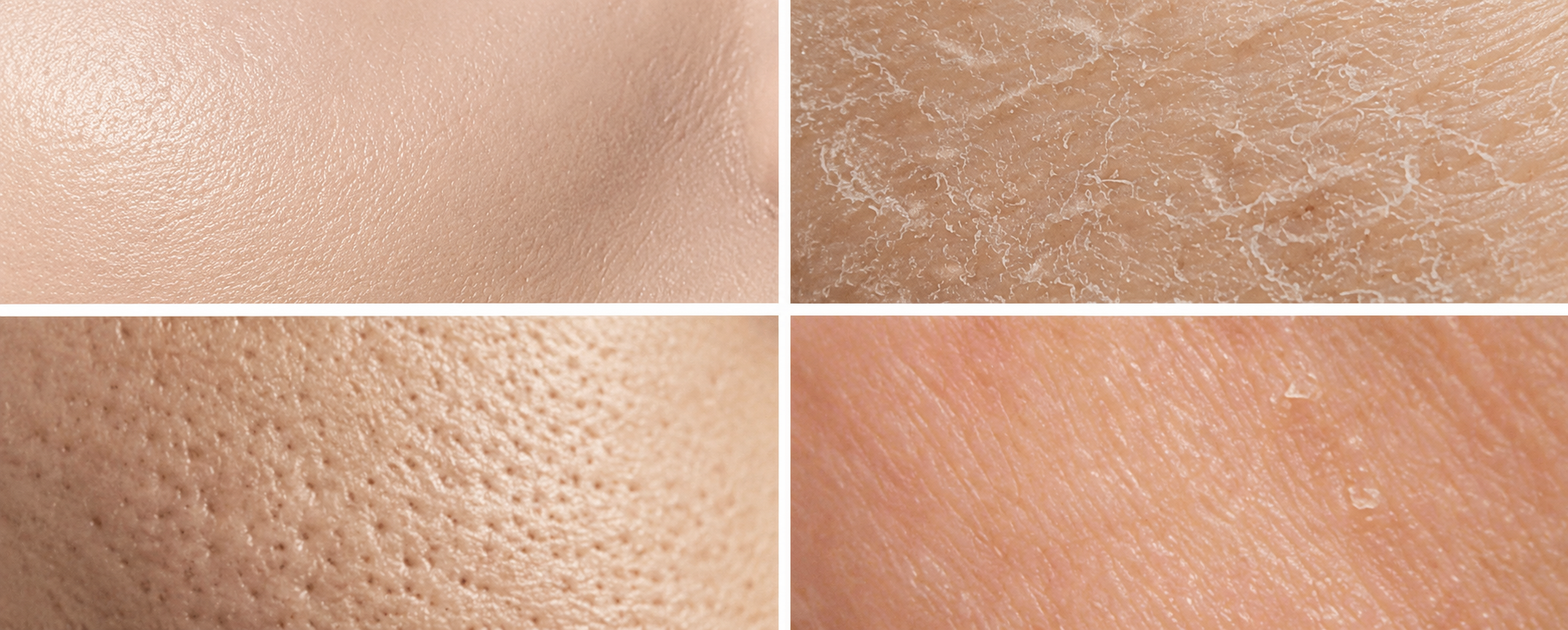 Skin Type vs. Skin Condition: What’s the Difference?