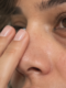 Eye Area Care: What Does This Delicate Area Really Need?
