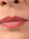 Upper Lip Wrinkles: Why They Appear and How to Care for This Area